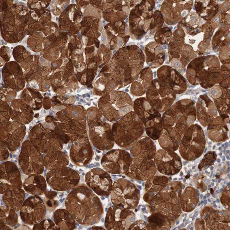 ST8SIA-VI Antibody - BSA Free Immunohistochemistry-Paraffin: ST8SIA-VI Antibody - BSA Free [NBP1-87042]