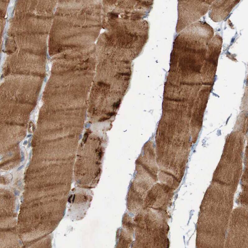 ST8SIA-VI Antibody - BSA Free Immunohistochemistry-Paraffin: ST8SIA-VI Antibody - BSA Free [NBP1-87042]