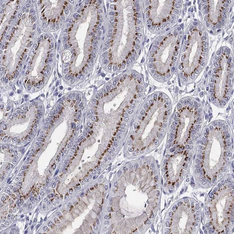 ST6GALNAC1 Antibody - BSA Free Immunohistochemistry-Paraffin: ST6GALNAC1 Antibody - BSA Free [NBP1-87043]