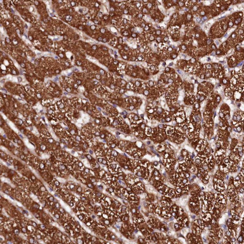 ST3 beta-Gal alpha-2,3-Sialyltransferase 1/ST3GAL1/SIAT4A Antibody - BSA Free Immunohistochemistry-Paraffin: ST3 beta-Gal alpha-2,3-Sialyltransferase 1/ST3GAL1/SIAT4A Antibody - BSA Free [NBP1-87045]