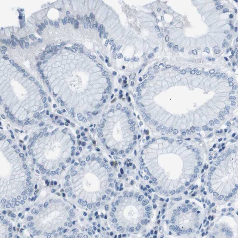 SRPK2 Antibody - BSA Free Immunohistochemistry-Paraffin: SRPK2 Antibody - BSA Free [NBP1-87049]