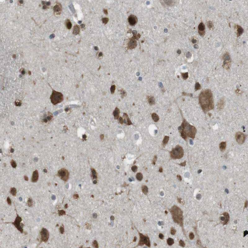 SRPK2 Antibody - BSA Free Immunohistochemistry-Paraffin: SRPK2 Antibody - BSA Free [NBP1-87049]