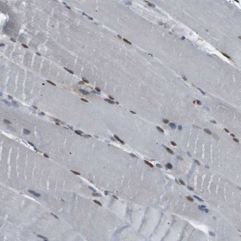 SRPK2 Antibody - BSA Free Immunohistochemistry-Paraffin: SRPK2 Antibody - BSA Free [NBP1-87049]