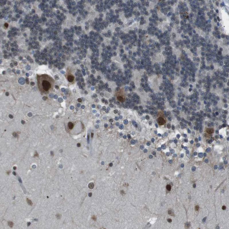 SRPK2 Antibody - BSA Free Immunohistochemistry-Paraffin: SRPK2 Antibody - BSA Free [NBP1-87049]