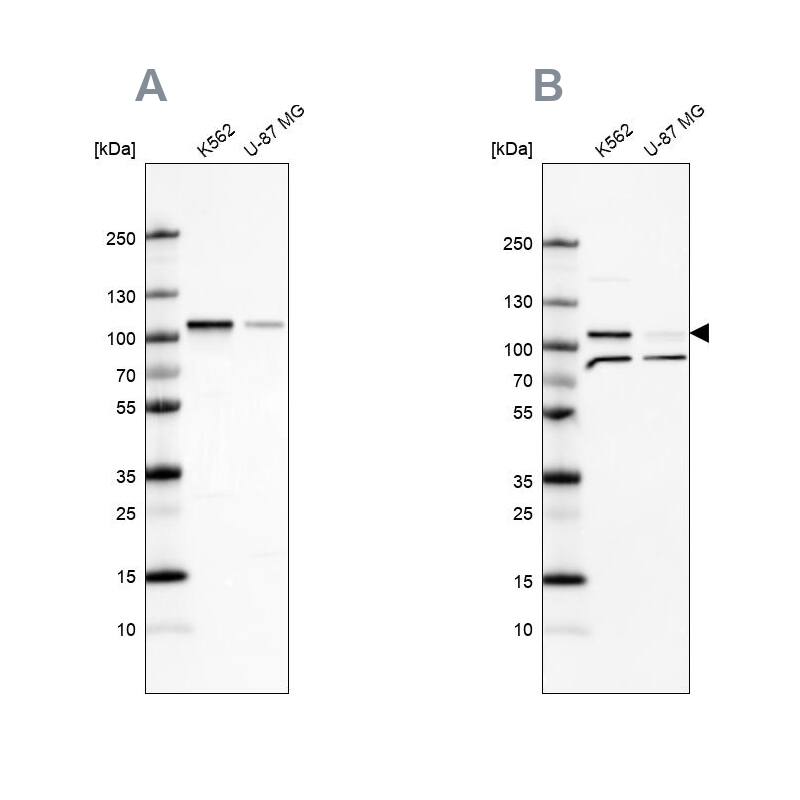 SRPK1 Antibody - BSA Free Western Blot: SRPK1 Antibody - BSA Free [NBP1-87050]