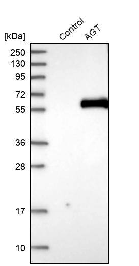 Serpin A8/Angiotensinogen Antibody - BSA Free Western Blot: Serpin A8/Angiotensinogen Antibody - BSA Free [NBP1-87053]