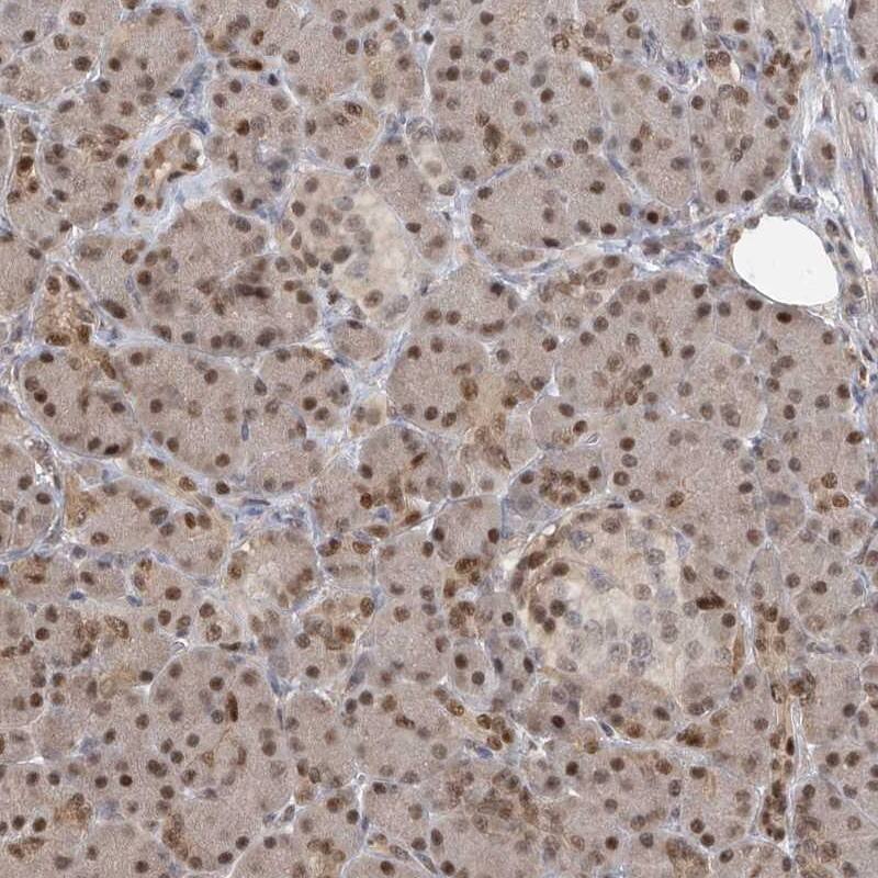PMM1/Phosphomannomutase 1 Antibody - BSA Free Immunohistochemistry-Paraffin: PMM1/Phosphomannomutase 1 Antibody [NBP1-87055]