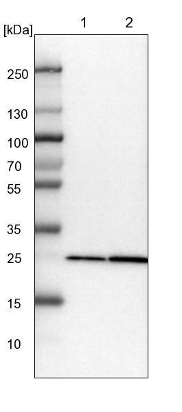 PMM1/Phosphomannomutase 1 Antibody - BSA Free Western Blot: PMM1/Phosphomannomutase 1 Antibody - BSA Free [NBP1-87055]