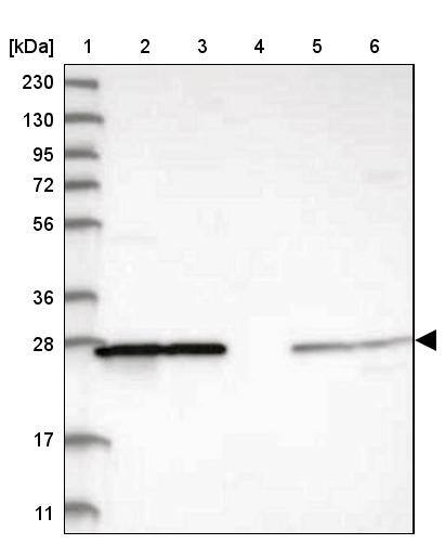 PMM1/Phosphomannomutase 1 Antibody - BSA Free Western Blot: PMM1/Phosphomannomutase 1 Antibody - BSA Free [NBP1-87055]