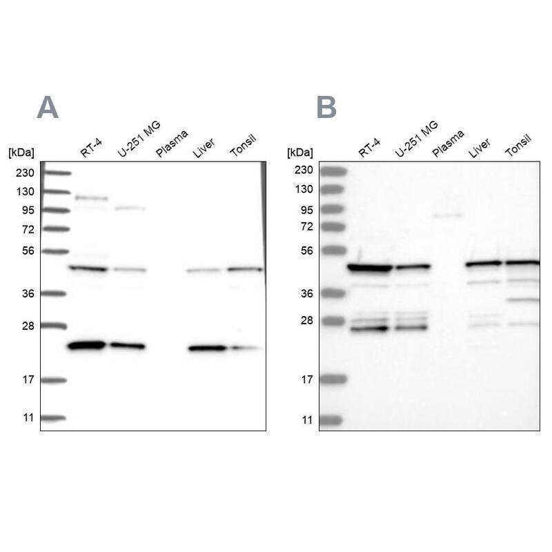 PPP1R7 Antibody Western Blot: PPP1R7 Antibody Antibody [NBP1-87059]