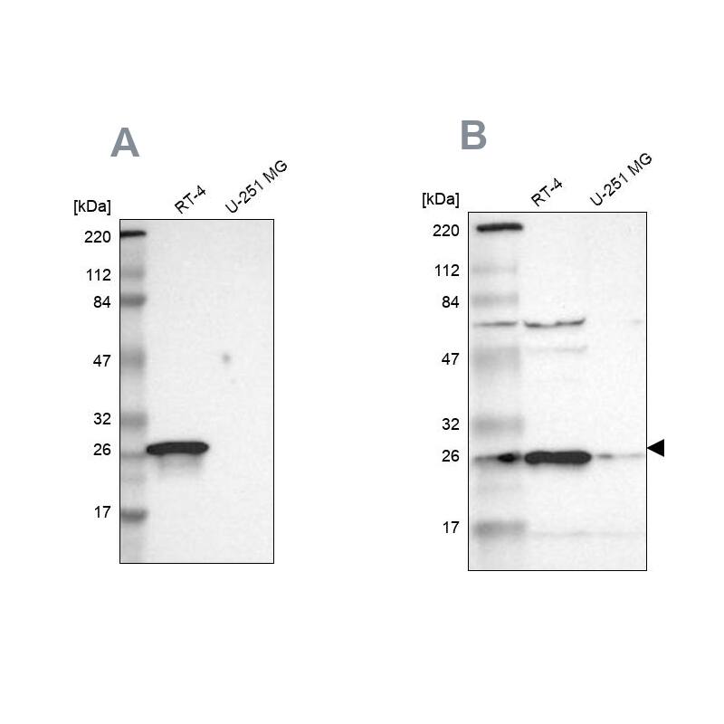 15-PGDH/HPGD Antibody - BSA Free Western Blot: 15-PGDH/HPGD Antibody - BSA Free [NBP1-87061]