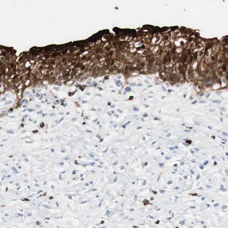 15-PGDH/HPGD Antibody - BSA Free Immunohistochemistry-Paraffin: 15-PGDH/HPGD Antibody - BSA Free [NBP1-87062]
