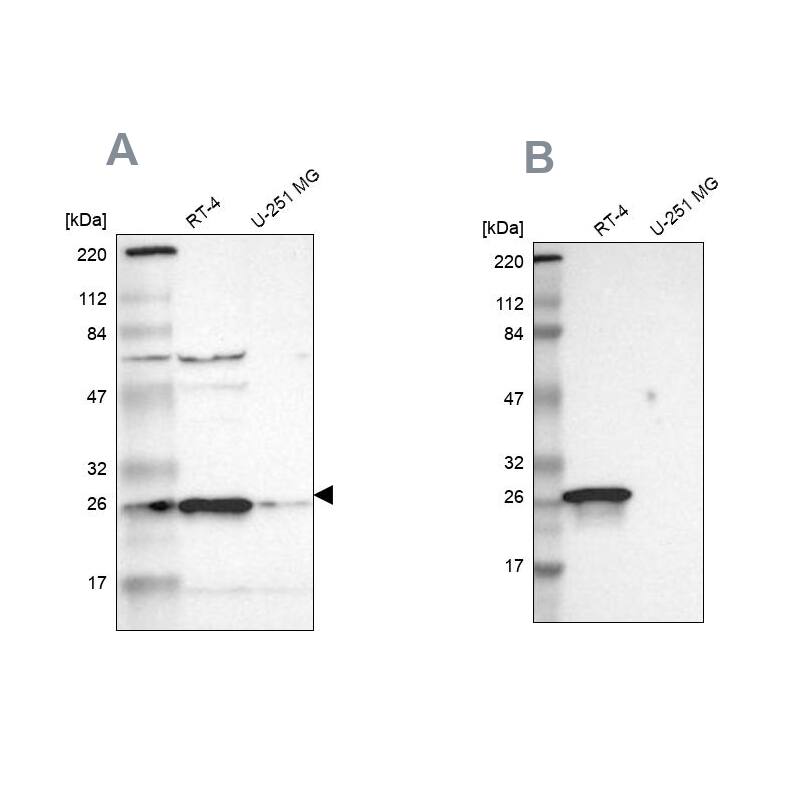 15-PGDH/HPGD Antibody - BSA Free Western Blot: 15-PGDH/HPGD Antibody - BSA Free [NBP1-87062]