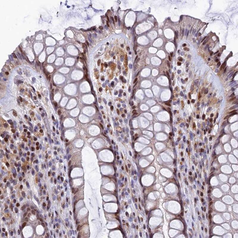 TGDS Antibody - BSA Free Immunohistochemistry-Paraffin: TGDS Antibody [NBP1-87063]