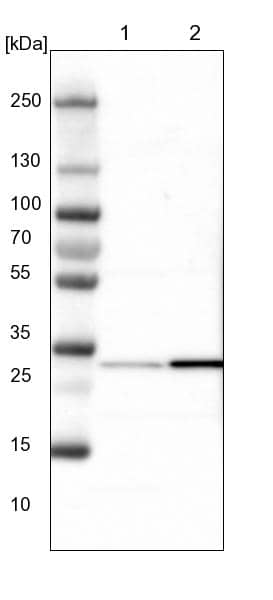CBR3 Antibody - BSA Free Western Blot: CBR3 Antibody - BSA Free [NBP1-87065]