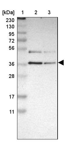 GALE Antibody - BSA Free Western Blot: GALE Antibody - BSA Free [NBP1-87066]