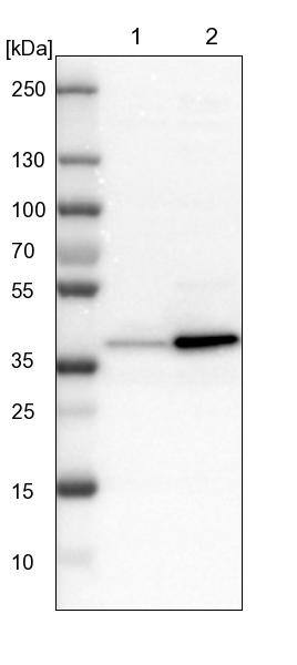 GALE Antibody - BSA Free Western Blot: GALE Antibody - BSA Free [NBP1-87066]