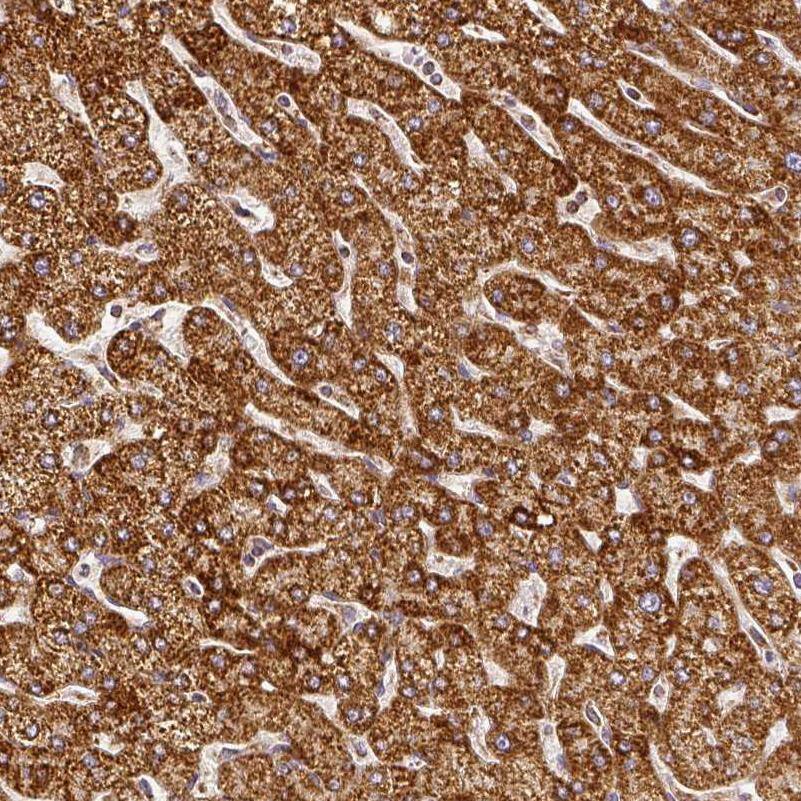 SDHB Antibody - BSA Free Immunohistochemistry-Paraffin: SDHB Antibody - BSA Free [NBP1-87069]
