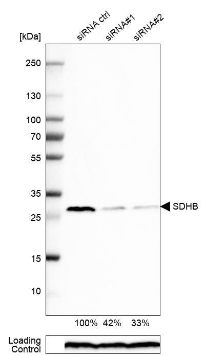 SDHB Antibody - BSA Free Western Blot: SDHB Antibody - BSA Free [NBP1-87069]