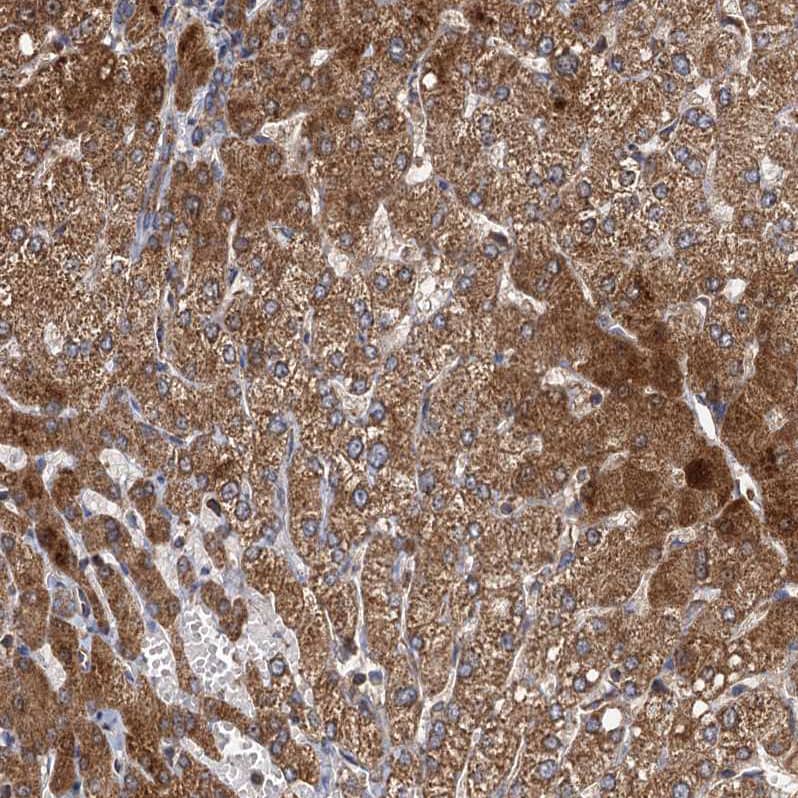 Serine Dehydratase Antibody Immunohistochemistry-Paraffin: Serine Dehydratase Antibody [NBP1-87070] -