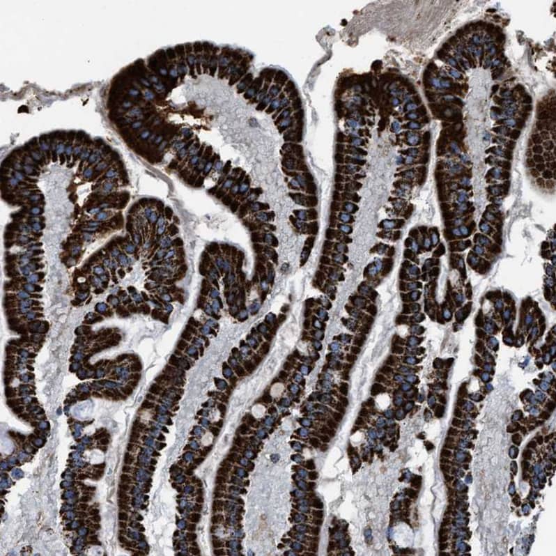ECHS1 Antibody - BSA Free Immunohistochemistry-Paraffin: ECHS1 Antibody - BSA Free [NBP1-87078]