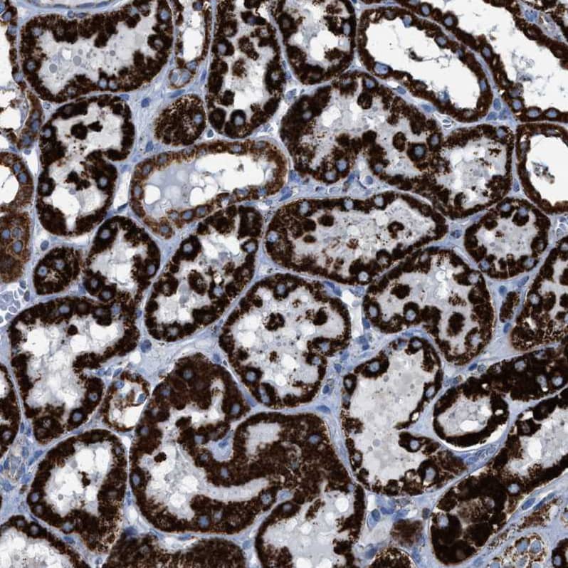 ECHS1 Antibody - BSA Free Immunohistochemistry-Paraffin: ECHS1 Antibody - BSA Free [NBP1-87078]