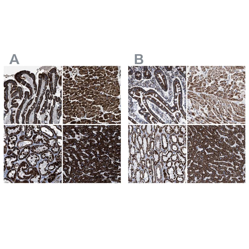 ECHS1 Antibody - BSA Free Immunohistochemistry-Paraffin: ECHS1 Antibody - BSA Free [NBP1-87078]
