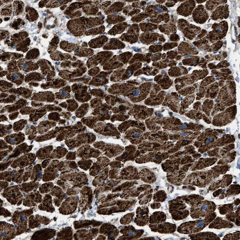 ECHS1 Antibody - BSA Free Immunohistochemistry-Paraffin: ECHS1 Antibody - BSA Free [NBP1-87078]
