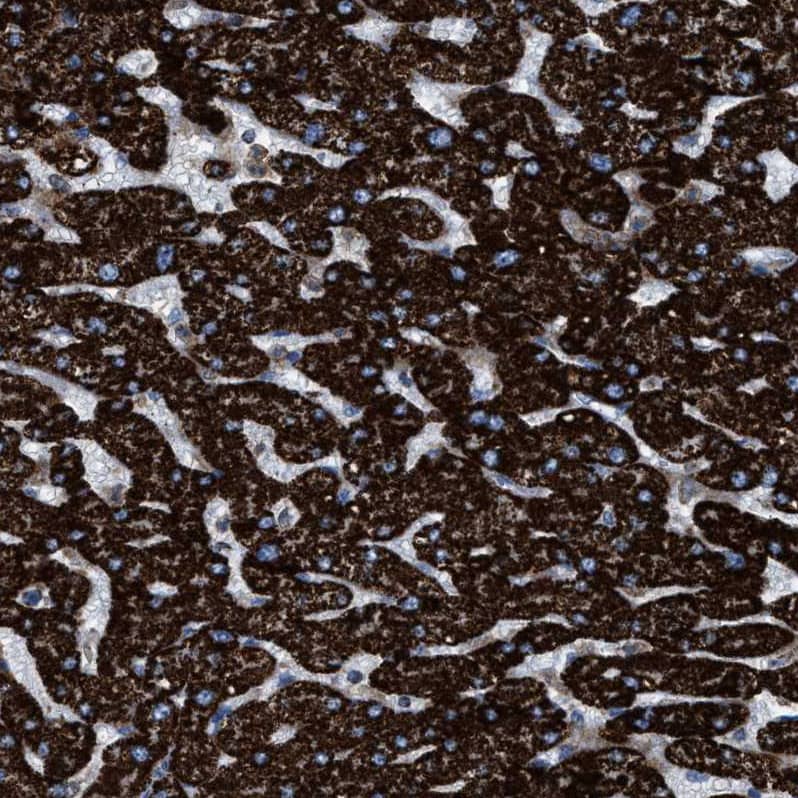 ECHS1 Antibody - BSA Free Immunohistochemistry-Paraffin: ECHS1 Antibody - BSA Free [NBP1-87078]