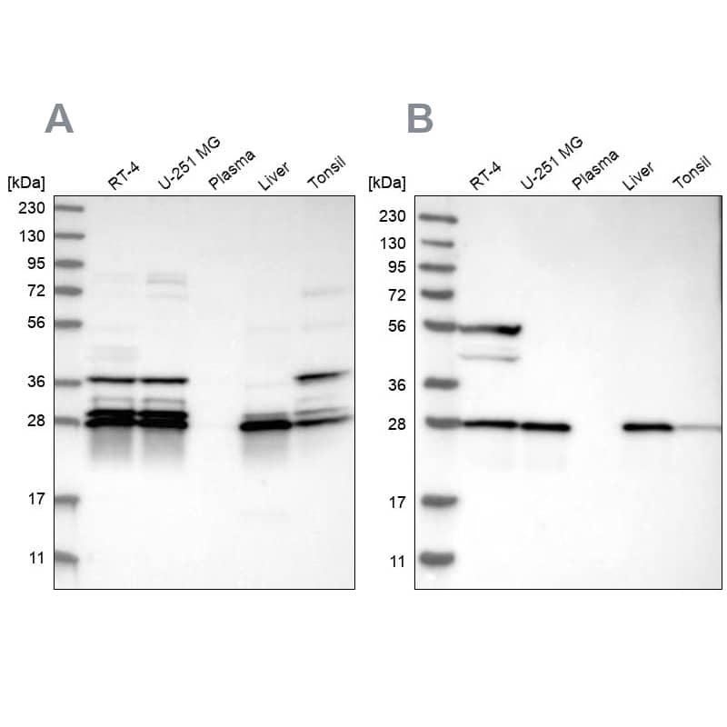 ECHS1 Antibody - BSA Free Western Blot: ECHS1 Antibody - BSA Free [NBP1-87078]