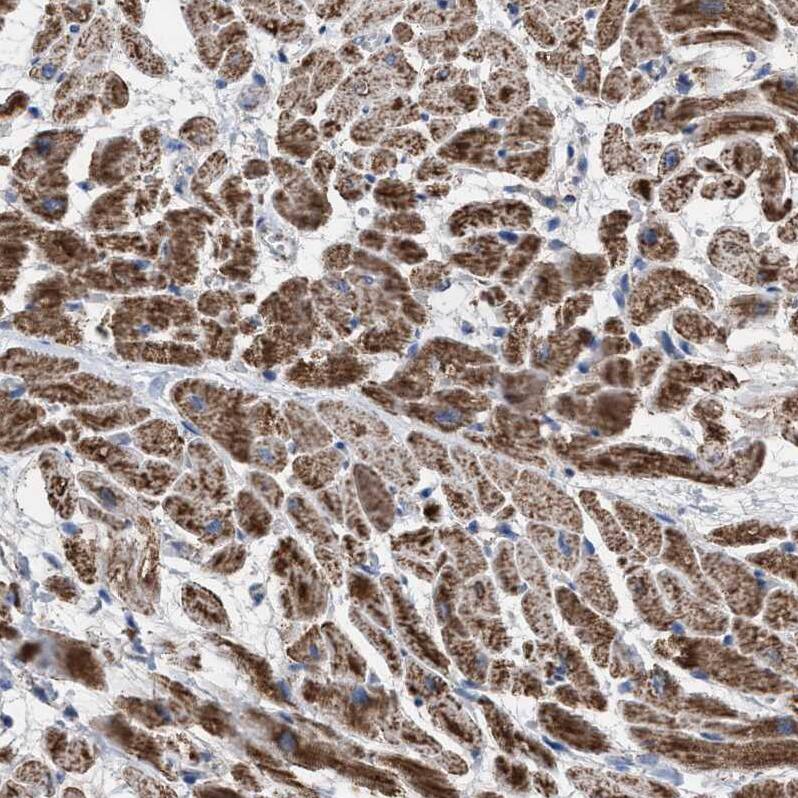 ECHS1 Antibody - BSA Free Immunohistochemistry-Paraffin: ECHS1 Antibody - BSA Free [NBP1-87079]