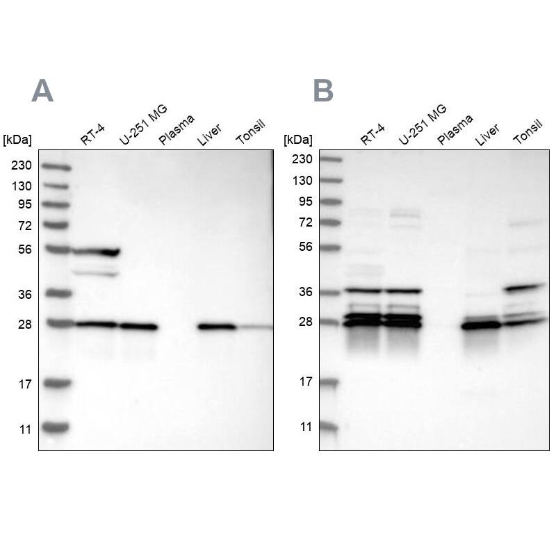 ECHS1 Antibody - BSA Free Western Blot: ECHS1 Antibody - BSA Free [NBP1-87079]