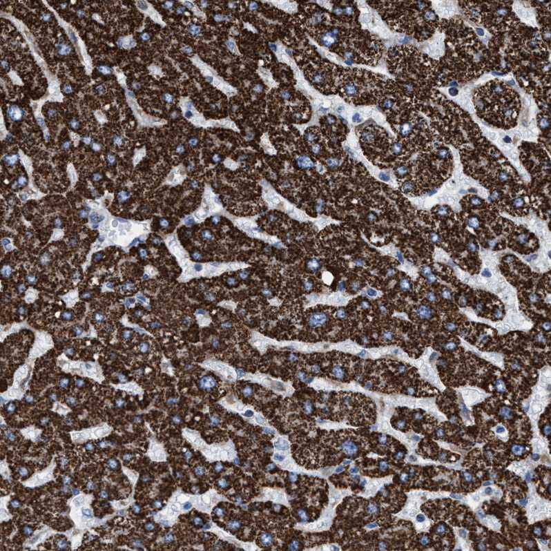ECHS1 Antibody - BSA Free Immunohistochemistry-Paraffin: ECHS1 Antibody - BSA Free [NBP1-87079]
