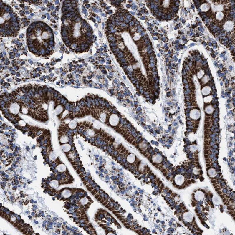 ECHS1 Antibody - BSA Free Immunohistochemistry-Paraffin: ECHS1 Antibody - BSA Free [NBP1-87079]