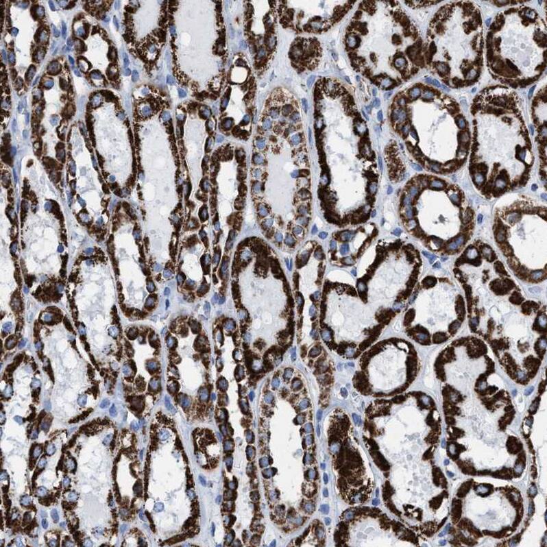 ECHS1 Antibody - BSA Free Immunohistochemistry-Paraffin: ECHS1 Antibody - BSA Free [NBP1-87079]