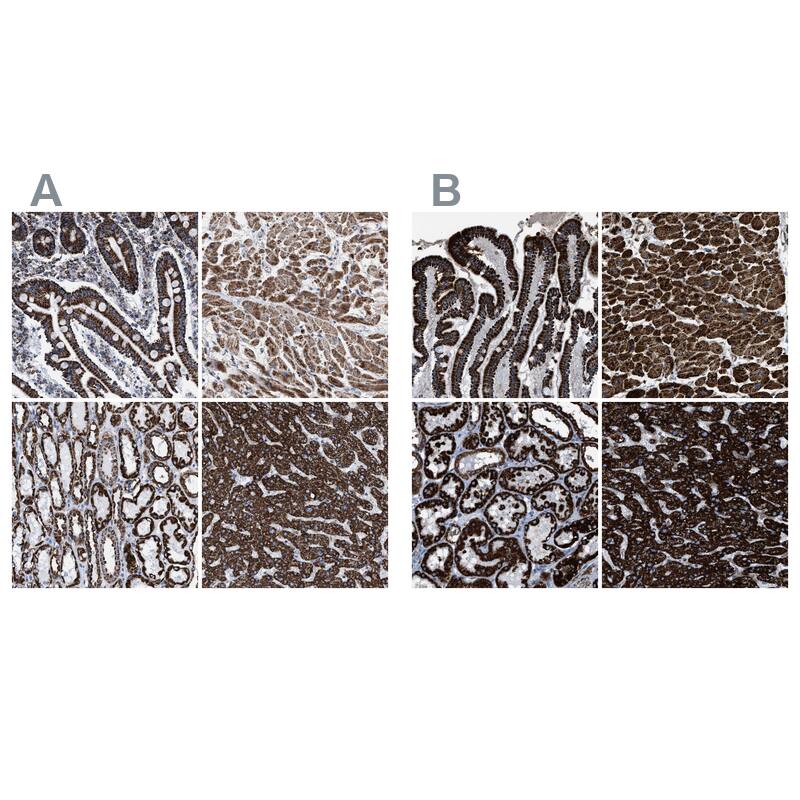 ECHS1 Antibody - BSA Free Immunohistochemistry-Paraffin: ECHS1 Antibody - BSA Free [NBP1-87079]