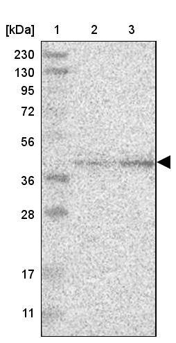 Calcium Activated Nucleotidase 1/CANT1 Antibody - BSA Free Western Blot: Calcium Activated Nucleotidase 1/CANT1 Antibody - BSA Free [NBP1-87081]