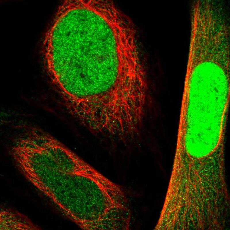 NANS Antibody - BSA Free Immunohistochemistry-Paraffin: NANS Antibody - BSA Free [NBP1-87088]