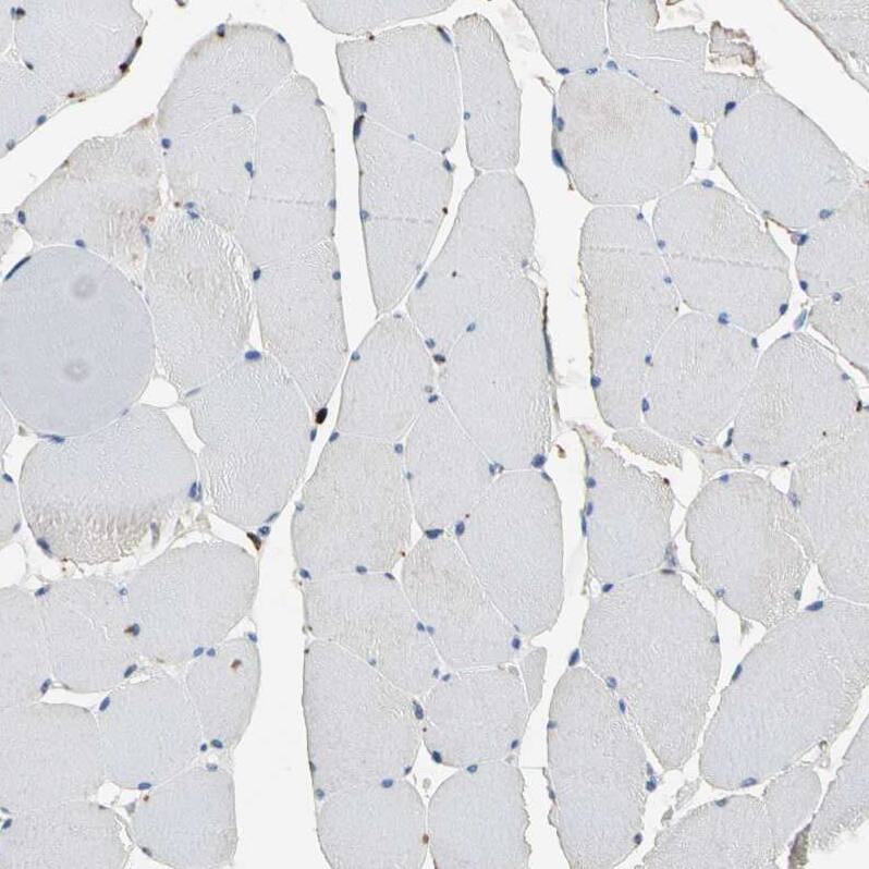 GM2A Antibody - BSA Free Immunohistochemistry-Paraffin: GM2A Antibody - BSA Free [NBP1-87090]