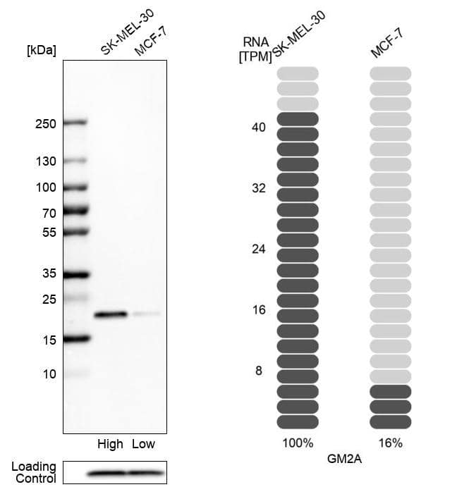 GM2A Antibody - BSA Free Western Blot: GM2A Antibody - BSA Free [NBP1-87090]