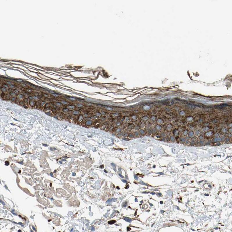 GM2A Antibody - BSA Free Immunohistochemistry-Paraffin: GM2A Antibody - BSA Free [NBP1-87090]