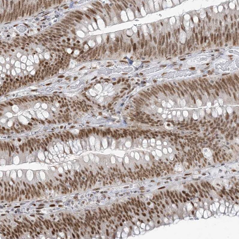 SA1 Antibody Immunohistochemistry-Paraffin: SA1 Antibody [NBP1-87097] -
