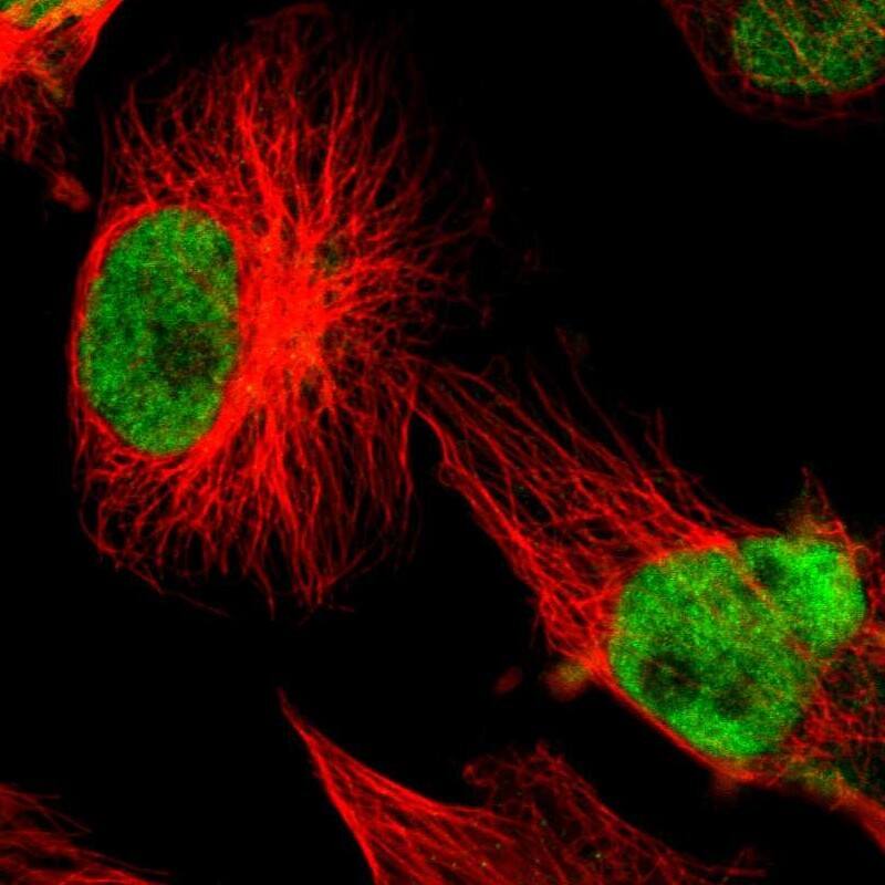 XRCC1 Antibody - BSA Free Immunocytochemistry/ Immunofluorescence: XRCC1 Antibody [NBP1-87154]
