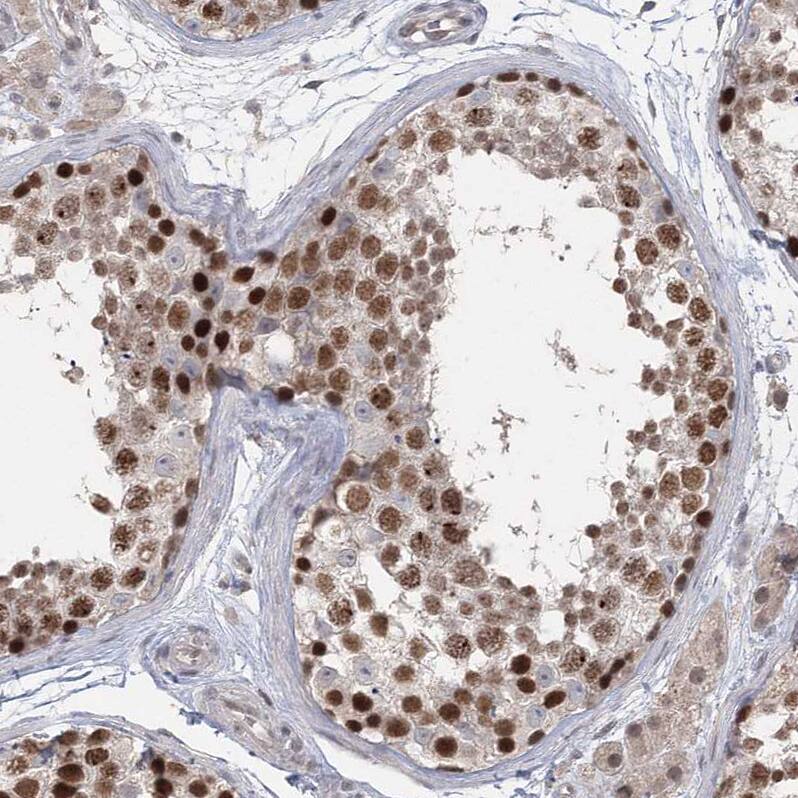RAP80 Antibody - BSA Free Immunohistochemistry-Paraffin: RAP80 Antibody [NBP1-87157]