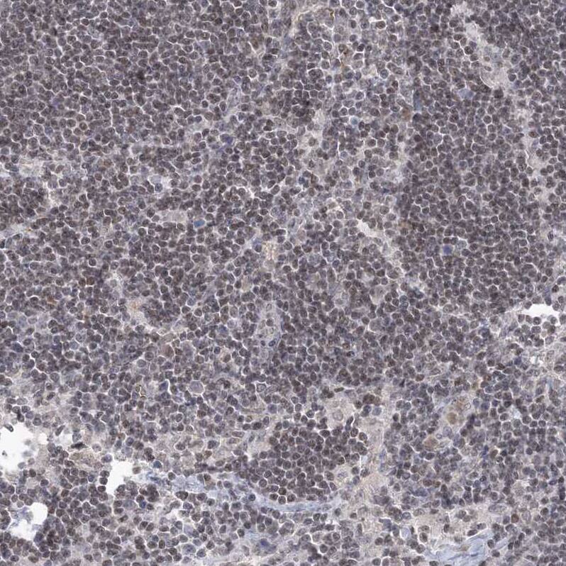 RAP80 Antibody - BSA Free Immunohistochemistry-Paraffin: RAP80 Antibody [NBP1-87157]