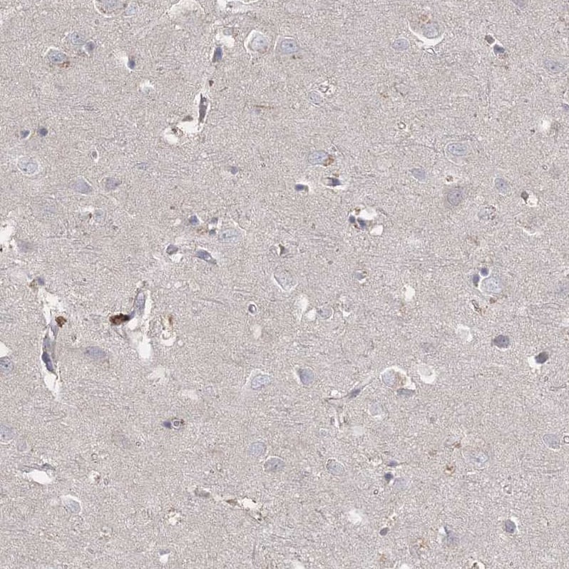 RAP80 Antibody - BSA Free Immunohistochemistry-Paraffin: RAP80 Antibody [NBP1-87157]