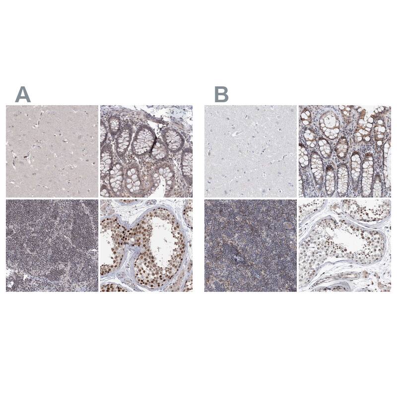 RAP80 Antibody - BSA Free Immunohistochemistry-Paraffin: RAP80 Antibody [NBP1-87157]