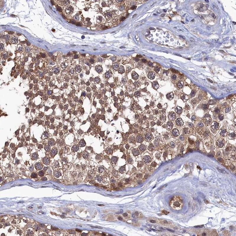 Ribonuclease Inhibitor Antibody - BSA Free Immunohistochemistry-Paraffin: Ribonuclease Inhibitor Antibody [NBP1-87161]