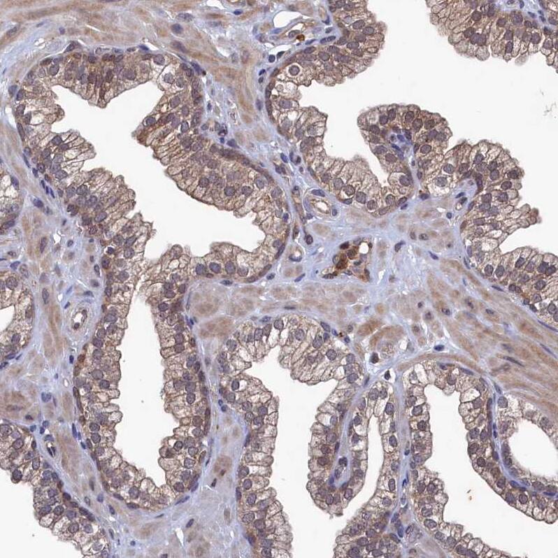 Ribonuclease Inhibitor Antibody - BSA Free Immunohistochemistry-Paraffin: Ribonuclease Inhibitor Antibody [NBP1-87161]