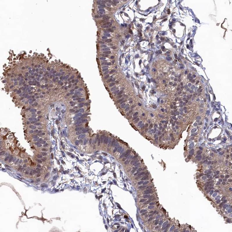 Ribonuclease Inhibitor Antibody - BSA Free Immunohistochemistry-Paraffin: Ribonuclease Inhibitor Antibody [NBP1-87161]
